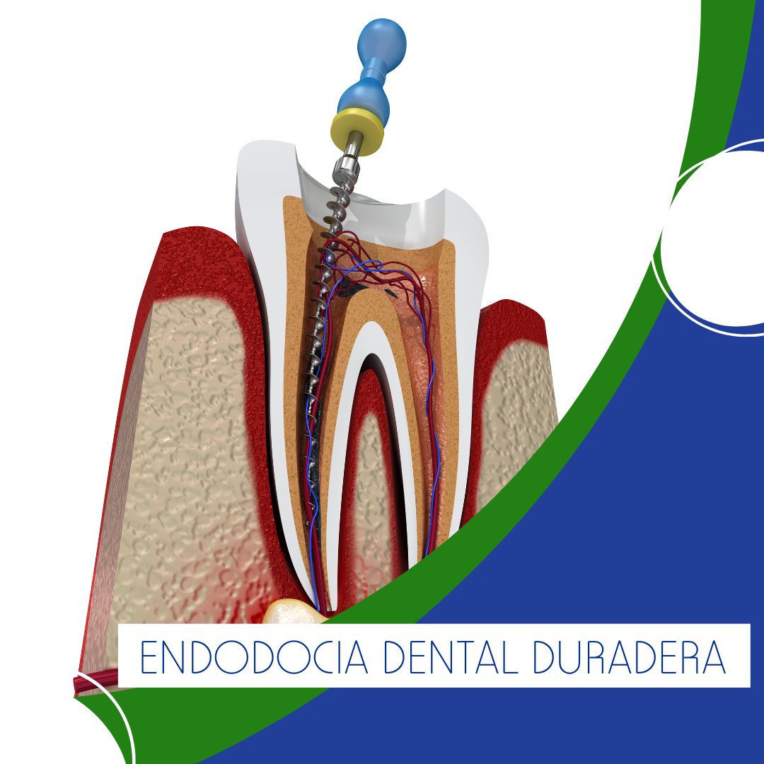 La endodoncia dental