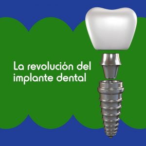 La revolución de los implantes dentales