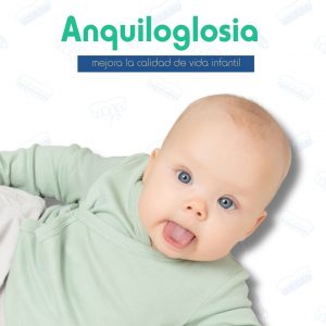 Nuevo tratamiento de anquiloglosia