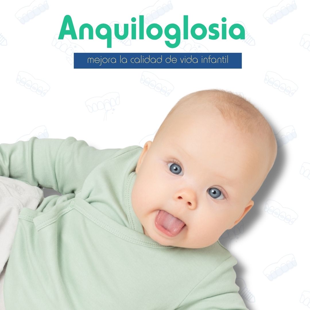 Nuevo tratamiento de anquiloglosia